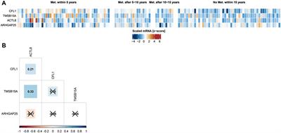 Transcriptome-based identification of key actin-binding proteins associated with high metastatic potential in breast cancer